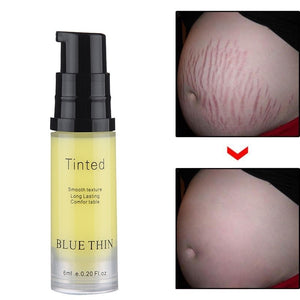 Remove Stretch Marks Cream Anti Wrinkle Anti Aging Maternity Skin Repair Remove Pregnancy Scars Treatment Body Skin Care